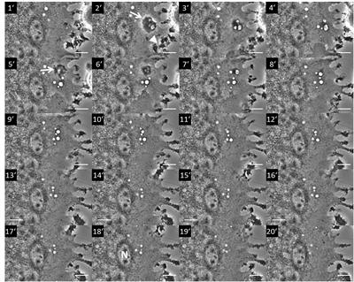 From Pinocytosis to Methuosis—Fluid Consumption as a Risk Factor for Cell Death